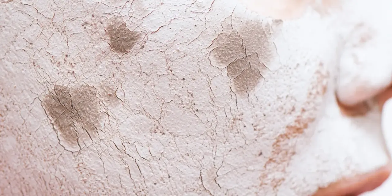 Textura agrietada de una mascarilla de arcilla sobre la piel, mostrando cómo protege la barrera cutánea.