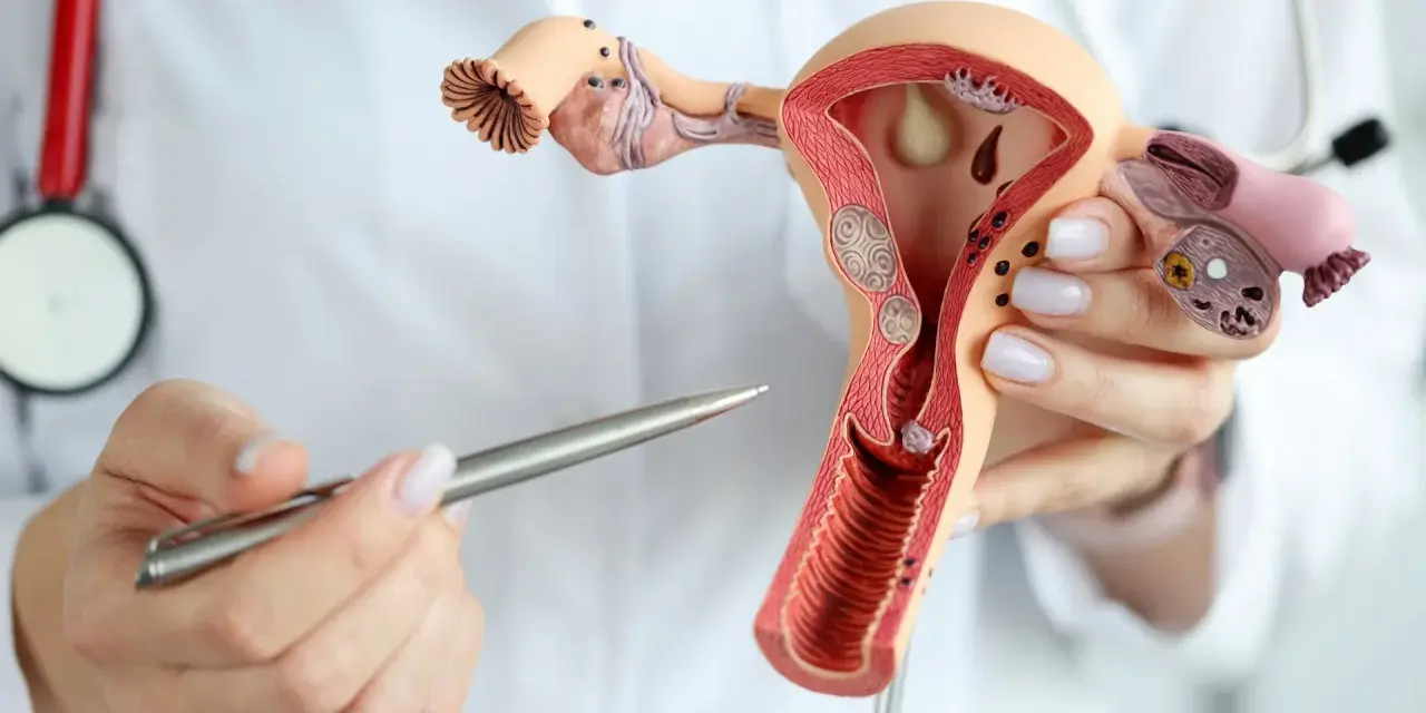 Model anatomiczny narządów rodnych kobiety z widocznym tyłozgięciem macicy i mięśniakami. Lekarz wskazuje na zmiany.