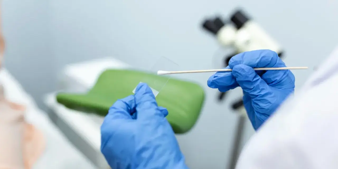 Ręce w niebieskich rękawiczkach przygotowują próbkę do badań cytologia wyniki. W tle mikroskop i fotel ginekologiczny.