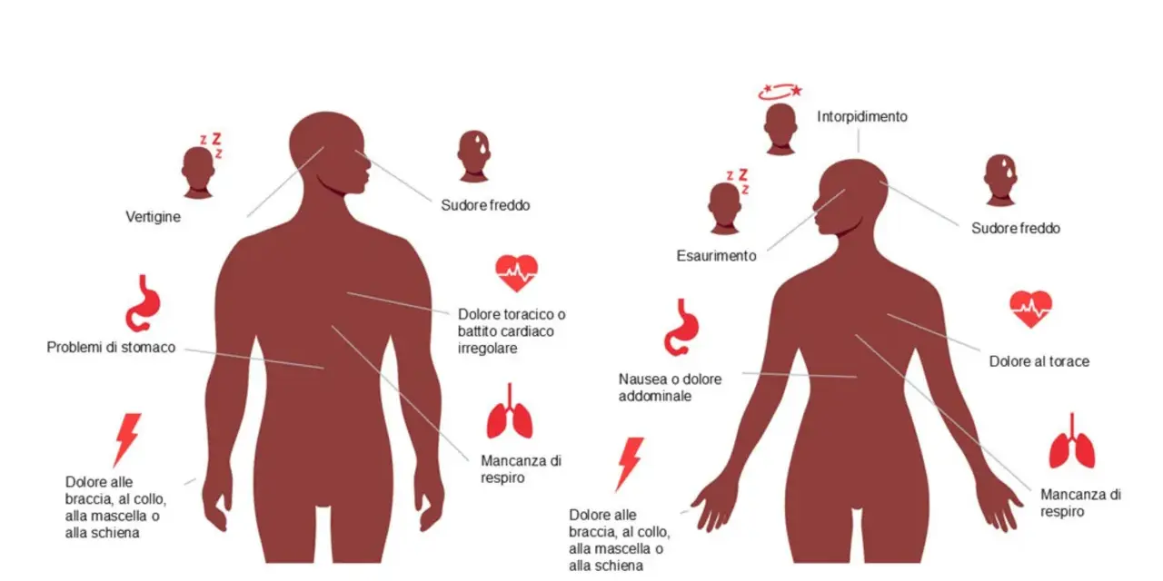 Sintomi infarto da stress: vertigini, sudore freddo, dolore toracico, nausea, intorpidimento, dolore a braccia/collo/mascella/schiena.