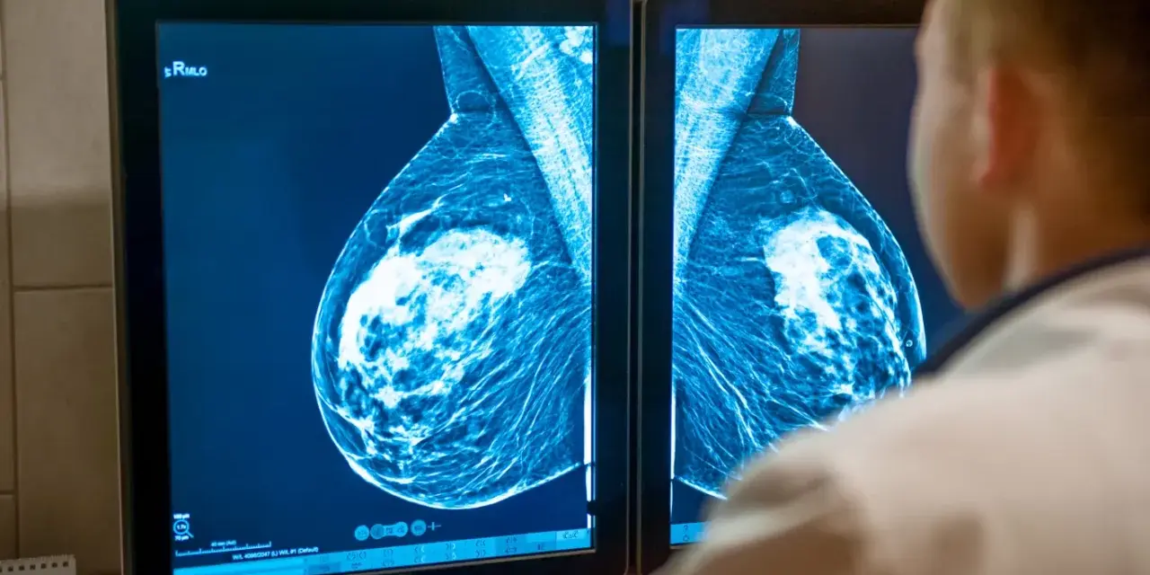Lekarz analizuje mammografię piersi na ekranie. Wyniki badań, jak te z systemu armidex, są kluczowe dla wczesnego wykrywania.