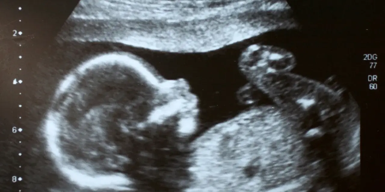 Ultraschallbild eines Babys, das sich im Mutterleib entwickelt. Ein kleiner Arm ist zu sehen, was auf einen ultraschall jungen hindeutet.