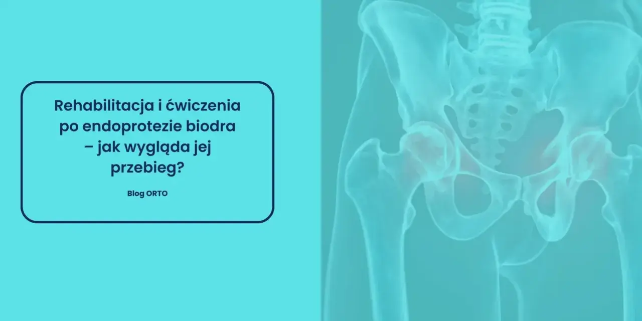 Kiedy rehabilitacja po endoprotezie kolana? Pełny plan powrotu!