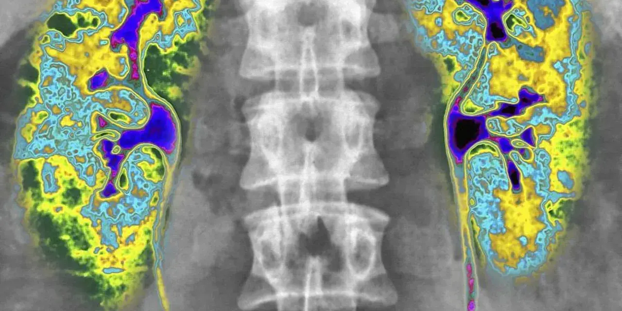 Kolorowa scyntygrafia kości pokazuje kręgosłup i obszary o zwiększonej aktywności metabolicznej, sugerujące potencjalne problemy.