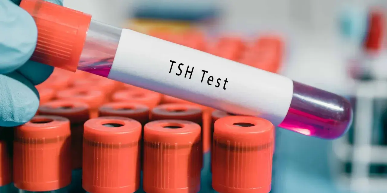 Ręka w niebieskiej rękawiczce trzyma probówkę z napisem "TSH Test". W tle widać rząd innych probówek z pomarańczowymi nakrętkami. Wynik TSH powyżej 100 może wskazywać na niedoczynność tarczycy.