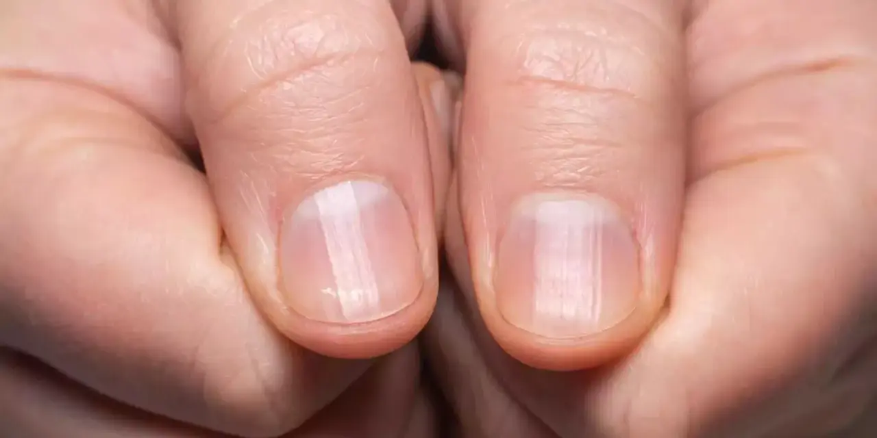 Des ongles fragiles ? Découvrez comment durcir les ongles recette de grand-mère pour des mains sublimes.