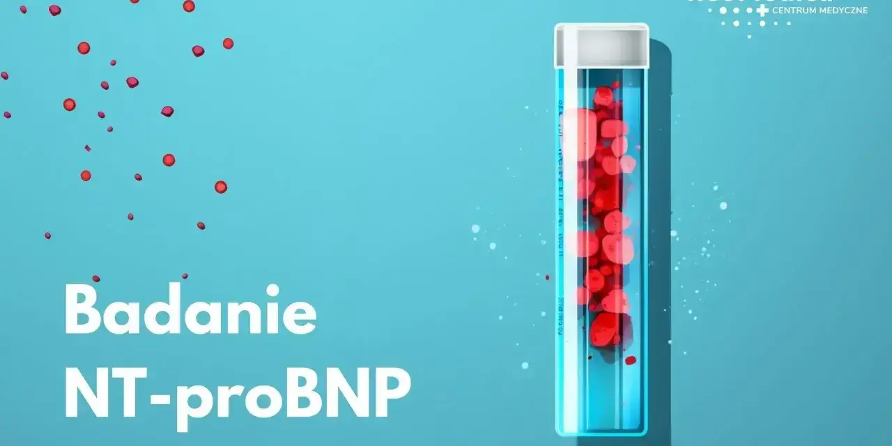 Badanie NT-proBNP. Próbka krwi w probówce, symbolizująca diagnostykę kardiologiczną.