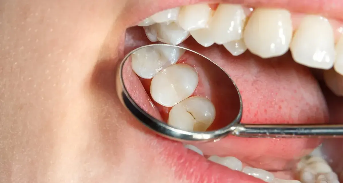 Znieczulenie u dentysty: czy jest bezpieczne? Fakty i mity