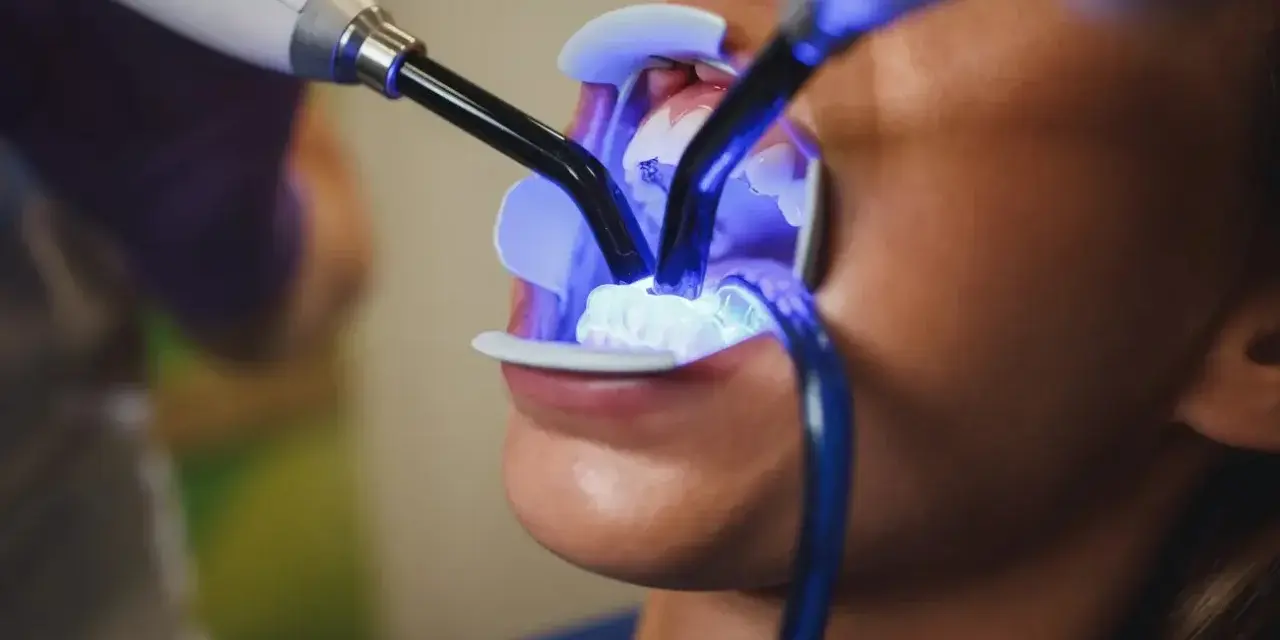 Jak wygląda wybielanie zębów u dentysty? Przewodnik krok po kroku
