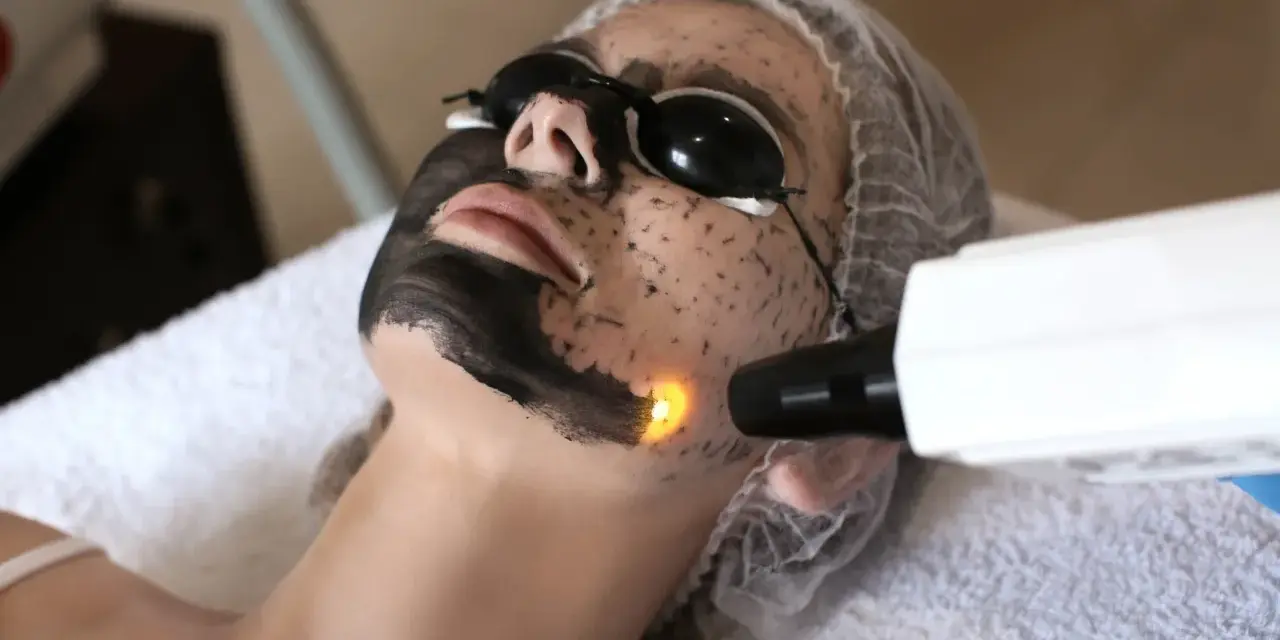 Kobieta z maską węglową na twarzy przechodzi zabieg laserowy.