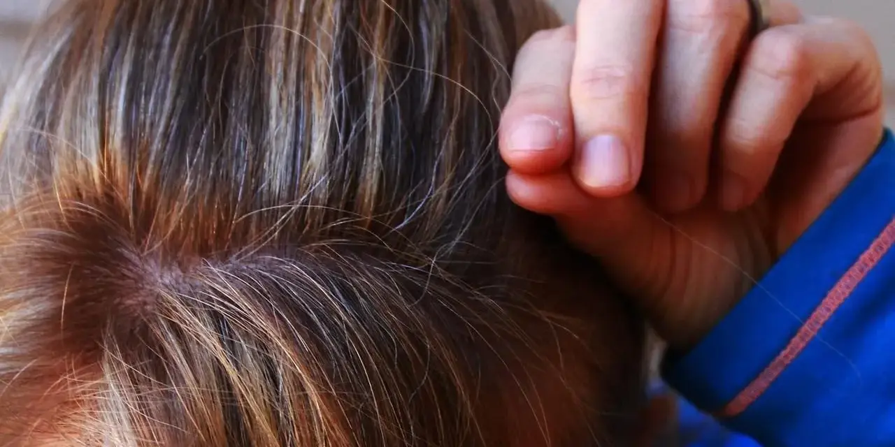 Dita che tirano i capelli, un gesto comune nella tricotillomania, a volte associata all'autismo.
