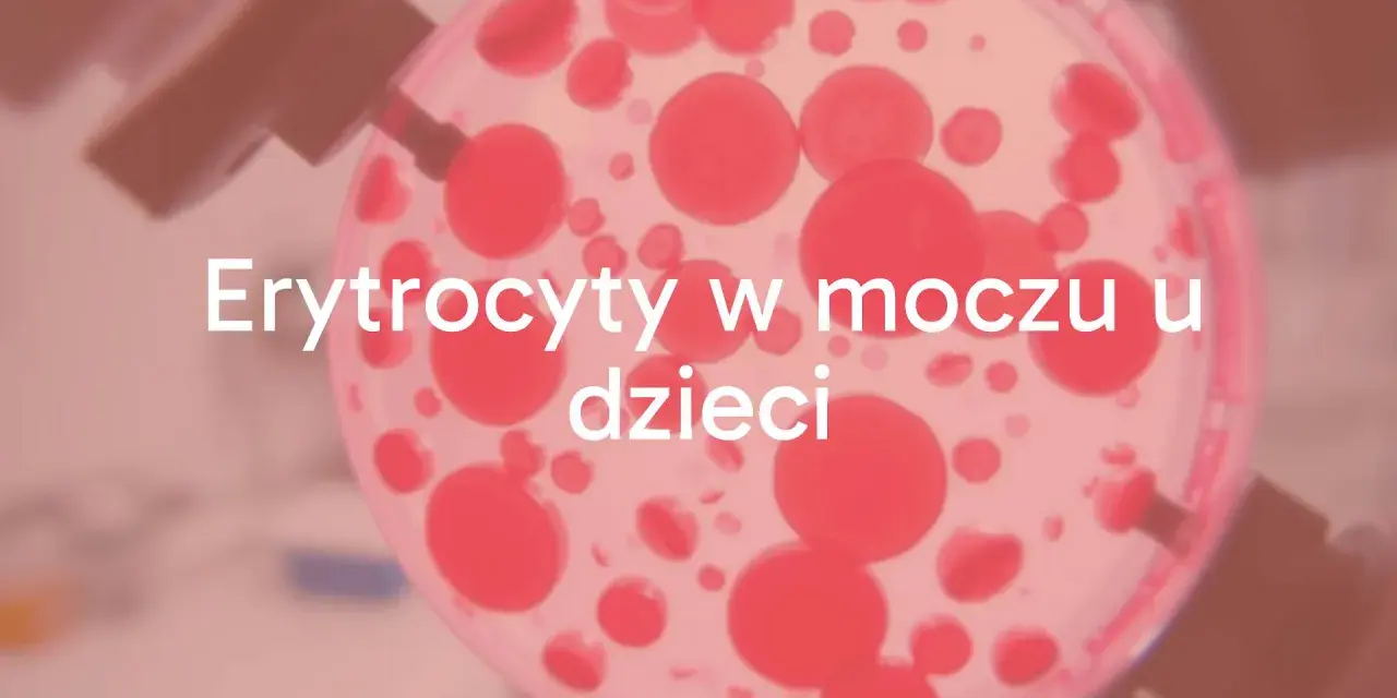 Badanie moczu: ogólne czy posiew? Zrozum różnice i diagnozę