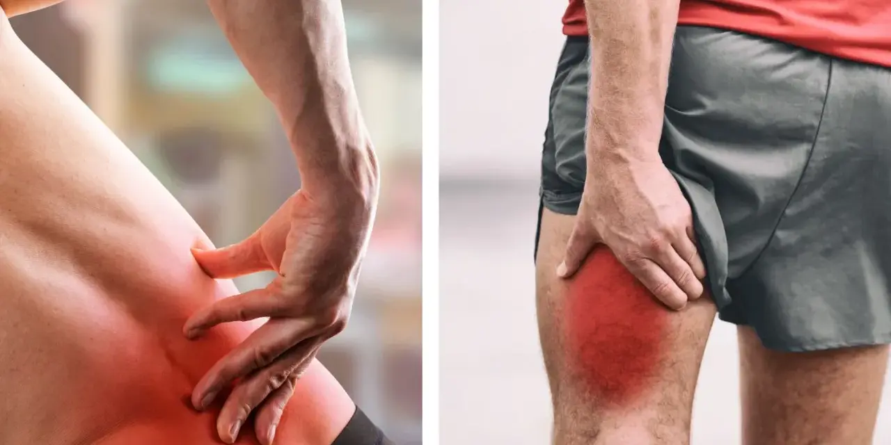 Douleur intense à la hanche et à la cuisse, signe de sciatique. Découvrez comment guerir une sciatique avec des exercices et des soins adaptés.
