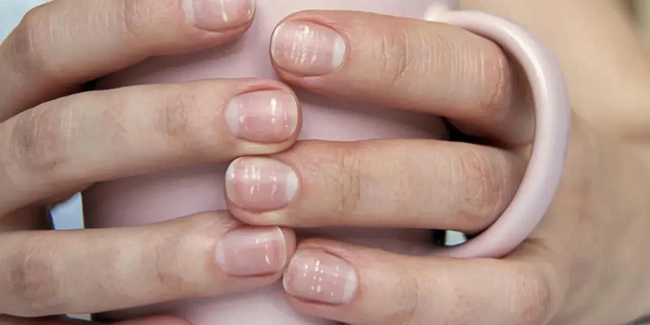 Mani con unghie deboli e striature bianche, che sorreggono una tazza rosa. Cosa fare per rinforzarle.