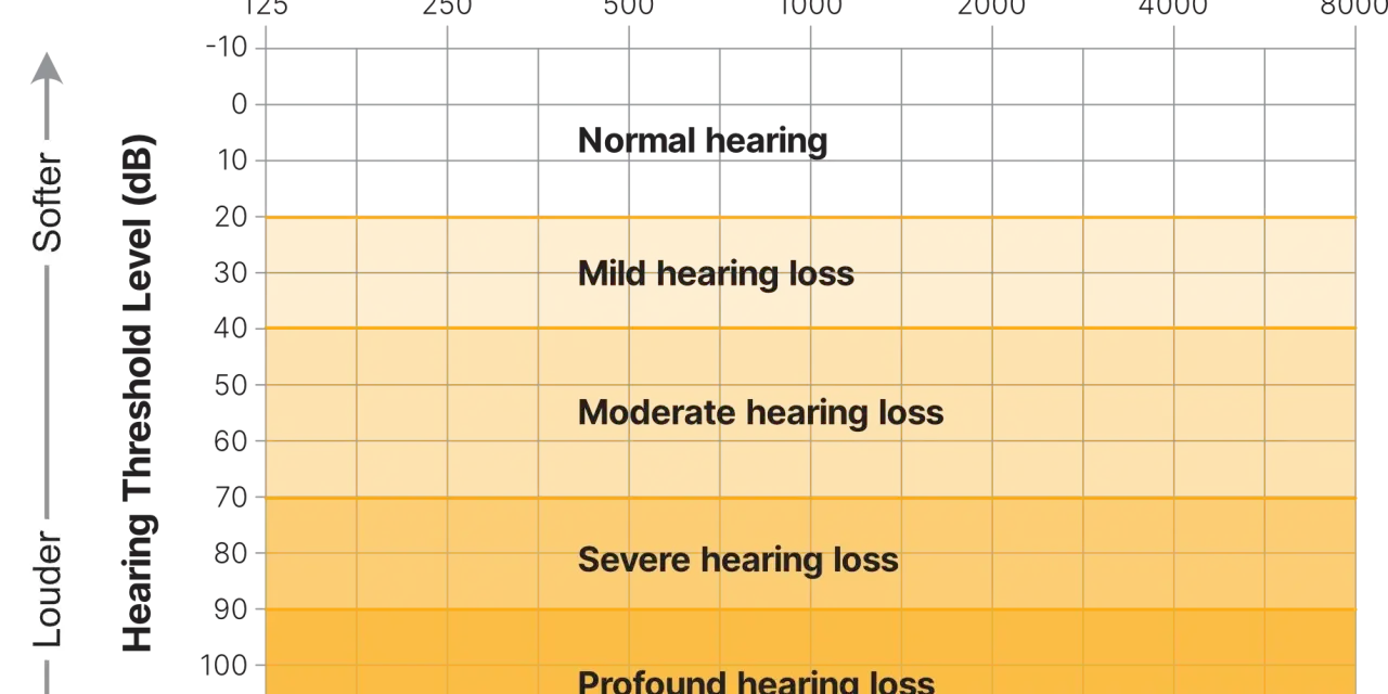 Graphique montrant les niveaux de perte auditive en fonction de la fréquence et du bruit decibel. De "normal hearing" à "profound hearing loss".