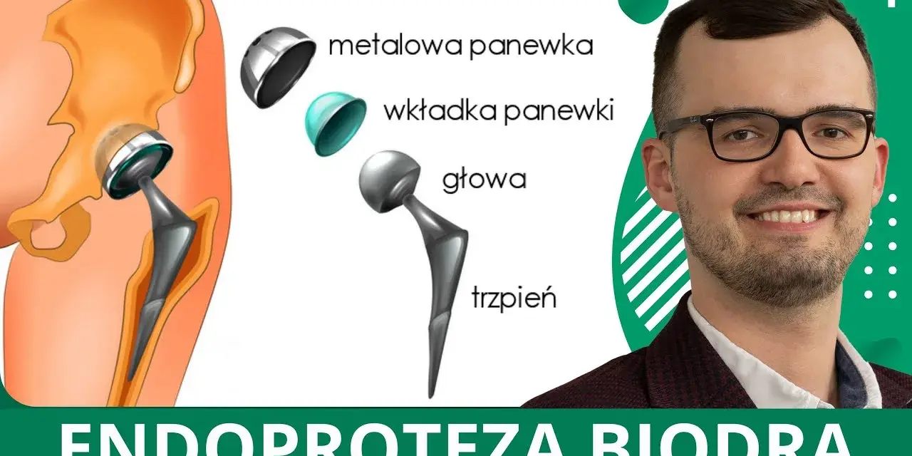 Jakie endoprotezy stawu biodrowego refunduje NFZ i ile kosztują?