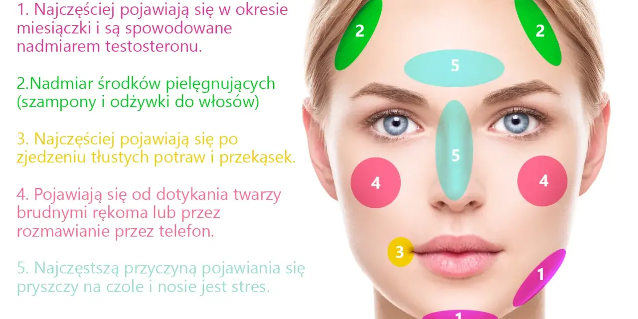 Dlaczego pryszcze wyskakują w tym samym miejscu? Sprawdź przyczyny