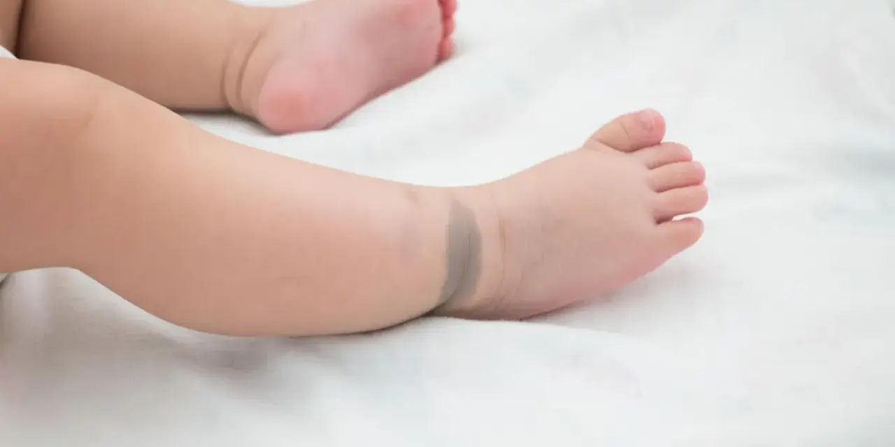 Babyfuß mit einem bläulichen mongolenfleck am Knöchel.