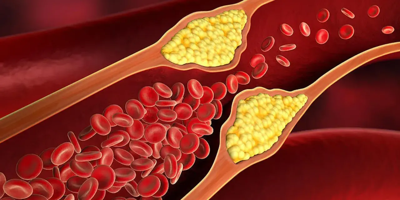 Die besten Medikamente bei Arteriosklerose: Wirkung und Kombinationen