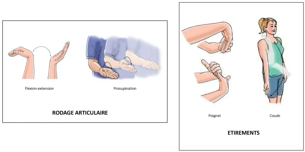 Exercices de mobilisation du poignet et du coude pour un épicondylite traitement naturel.