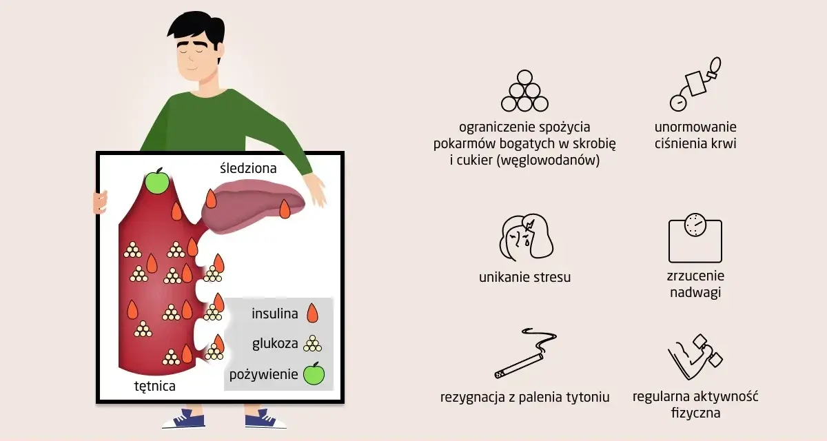 Ilustracja pokazuje, jak utrzymać prawidłowy **poziom cukru we krwi** poprzez dietę, aktywność fizyczną i unikanie stresu.