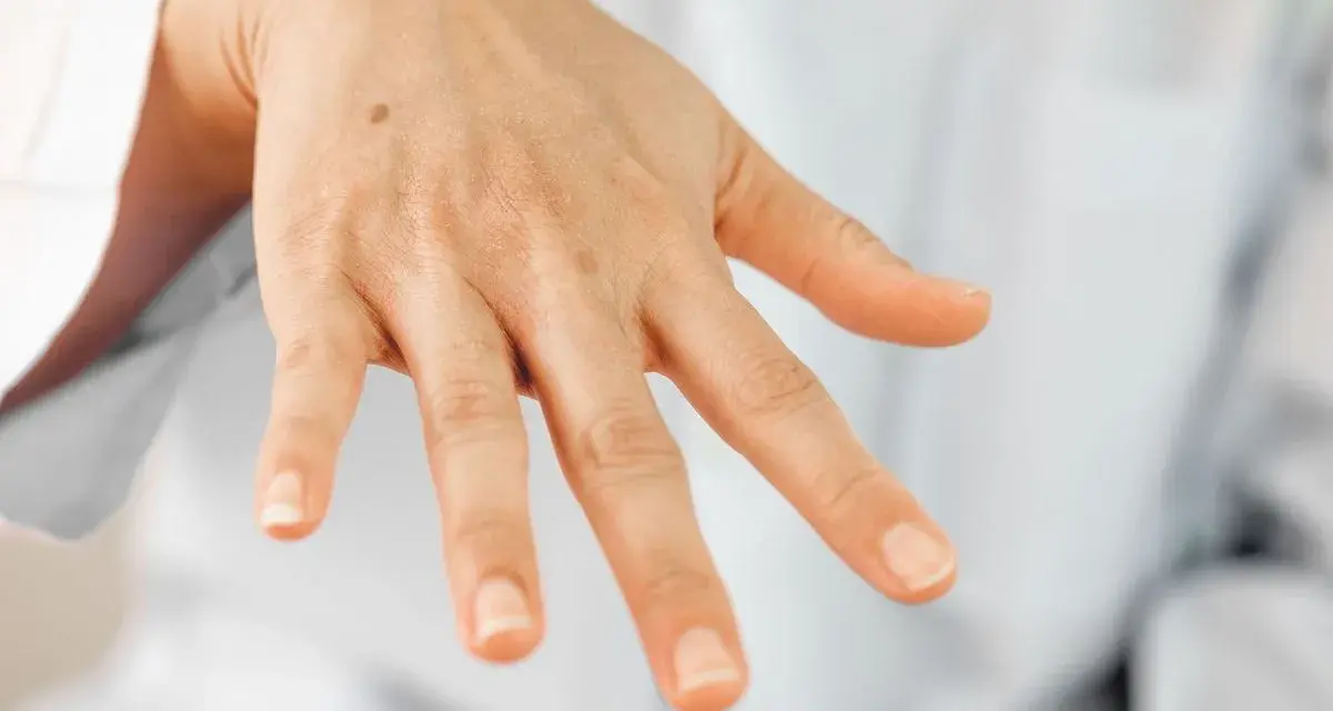 Una mano con algunas manchas, incluyendo un lunar visible en el dorso.
