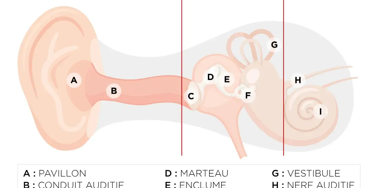 Schéma de l'oreille montrant les différentes parties. La cochlée (I) contient les cellules ciliées endommagées, essentielles à l'audition.
