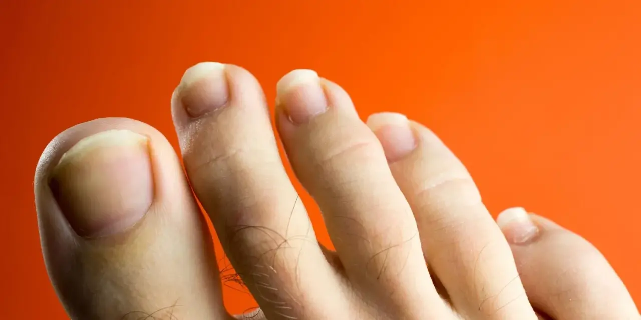Primer plano de unos pies con uñas amarillas sobre fondo naranja.