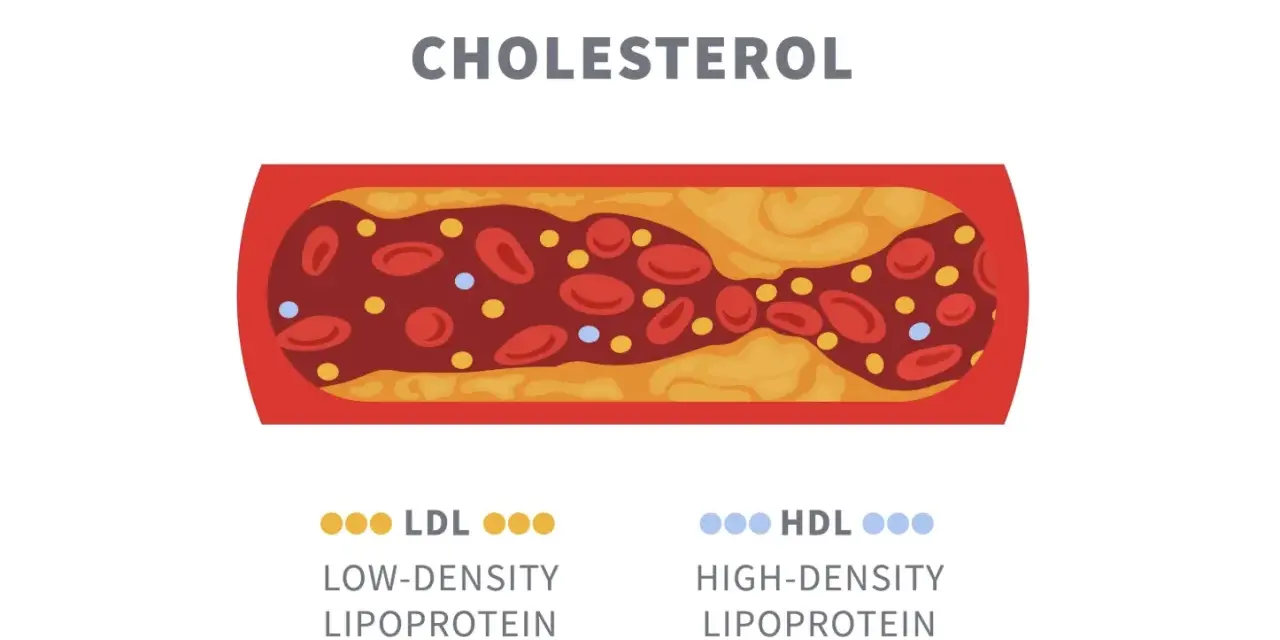 Niski cholesterol LDL sprzyja miażdżycy, tworząc złogi w naczyniach. Wysoki HDL chroni.