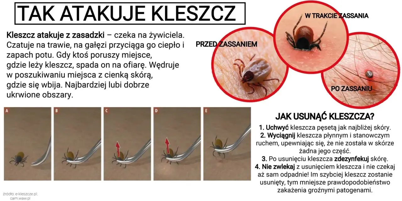 Kleszcz pod skórą to mit! Jak rozpoznać i bezpiecznie usunąć?