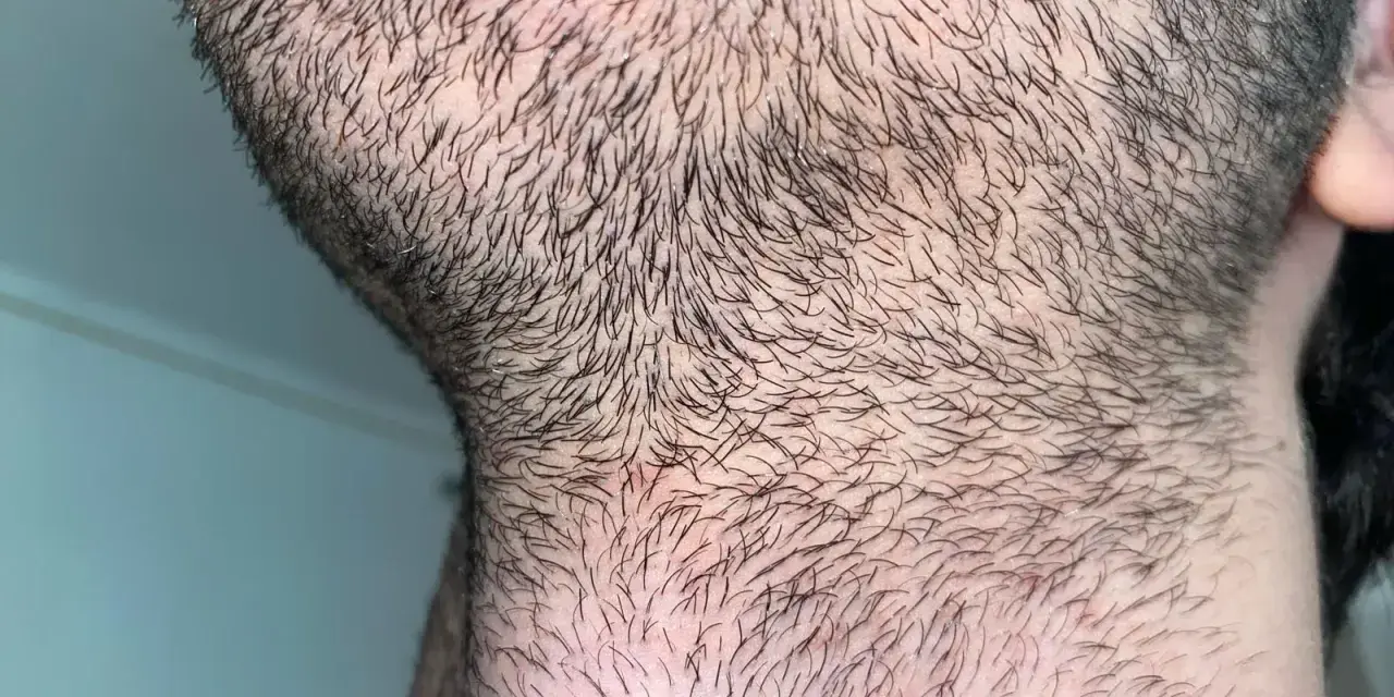Barba incipiente y cuello con vello corto. Para una piel suave, es bueno afeitarse todos los días.