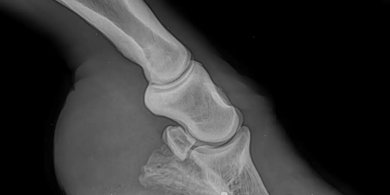 Radiographie d'un pied de cheval montrant la fourbure. L'aspirine est parfois utilisée pour soulager la douleur.