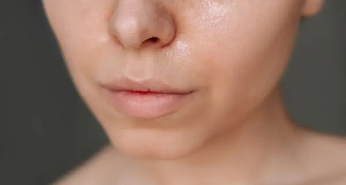 Nahaufnahme eines Gesichts, das zeigt, wie man fettige Haut pflegt. Die Haut glänzt leicht, was auf Feuchtigkeit hinweist.