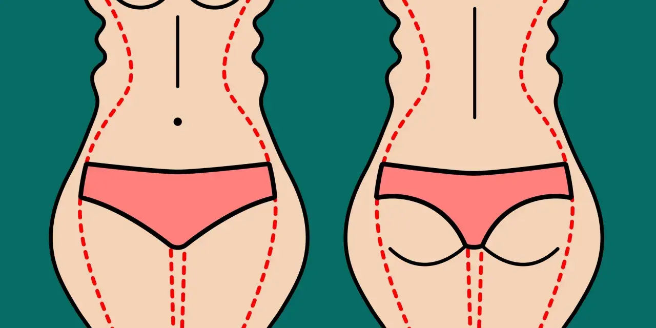 Ilustracja pokazuje sylwetkę przed i po zabiegu liposukcji ud. Czerwone linie zaznaczają obszary do modelowania.