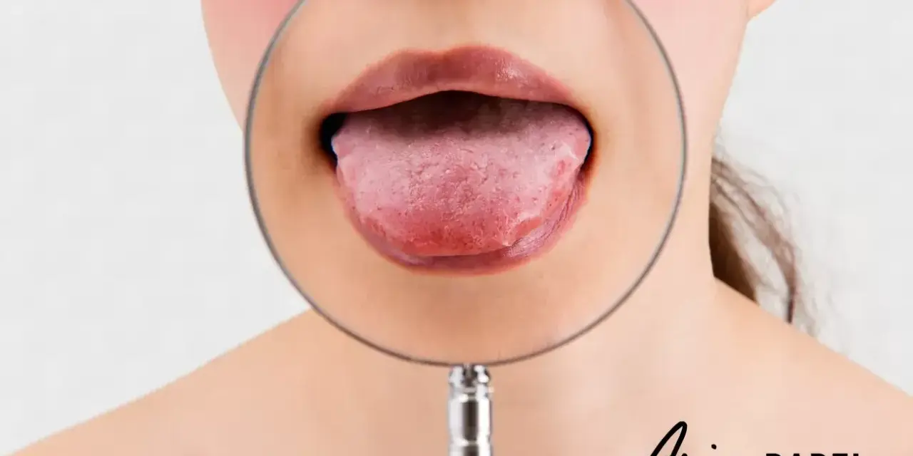 Powiększony pypeć na języku pod lupą.