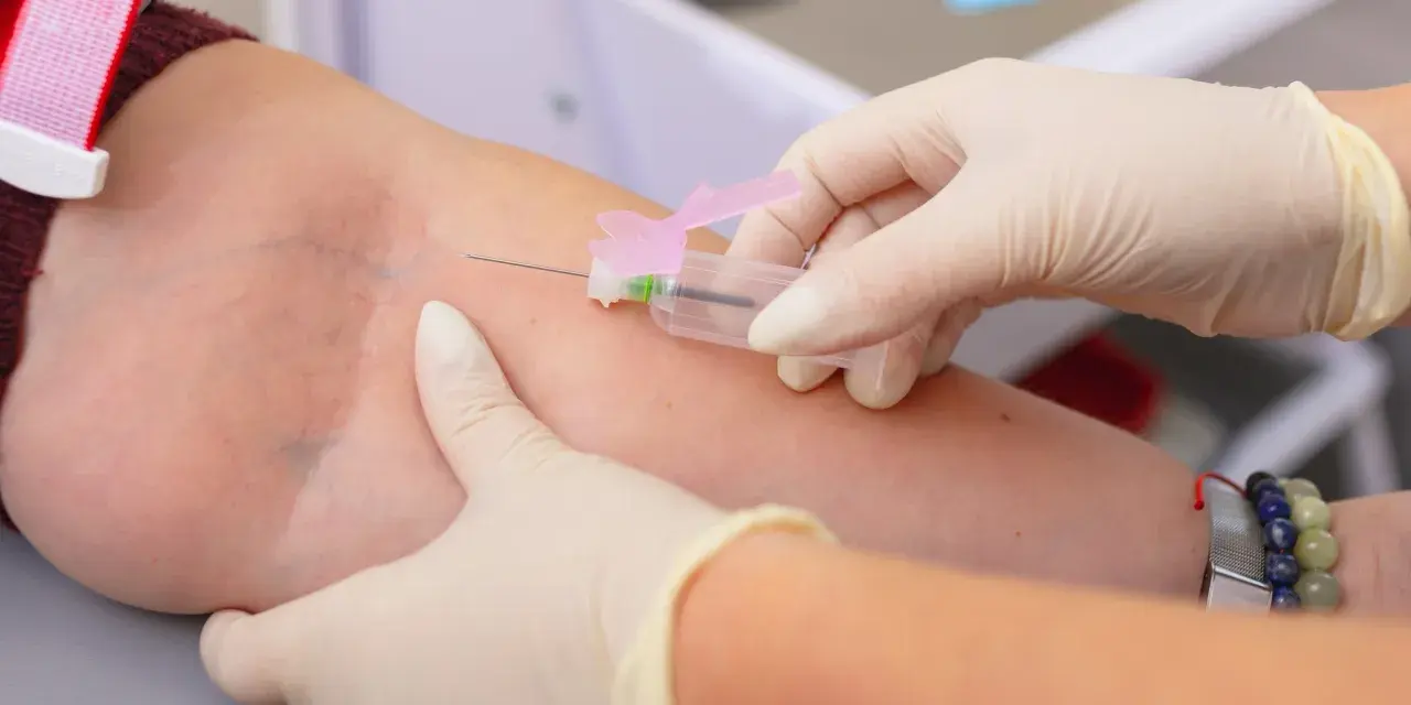 Pobieranie krwi do badań. Wyniki mogą wykazać, że limfocyty wysokie, co wymaga dalszej diagnostyki.