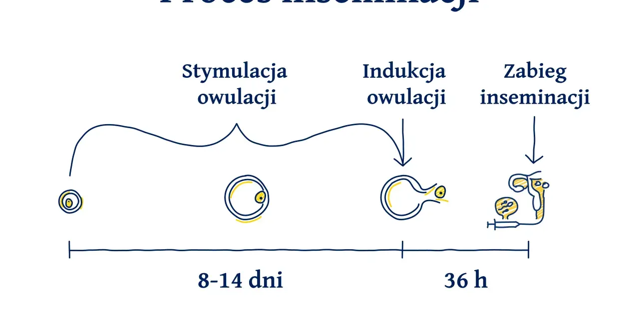 Schemat procesu inseminacji: od stymulacji owulacji (8-14 dni), przez indukcję owulacji, do zabiegu inseminacji (36 h).