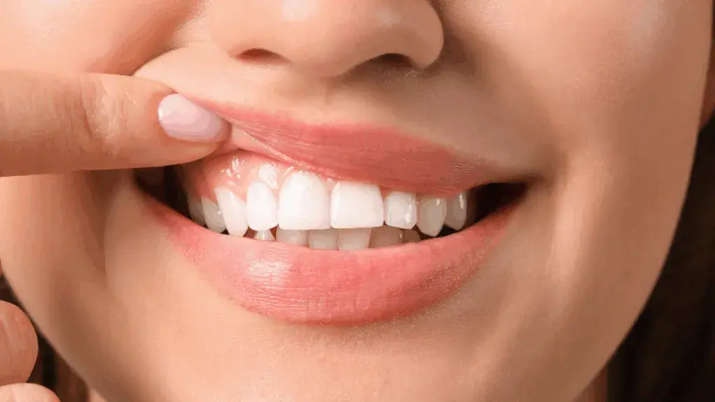 Bolące dziąsła: Jak szybko znaleźć ulgę i kiedy iść do dentysty?