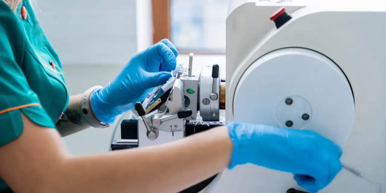 Ręce w niebieskich rękawiczkach pracują przy mikrotomie, przygotowując próbkę tkanki do badania. Może to być kluczowe dla diagnozy, czy wykryty guz jest złośliwy.