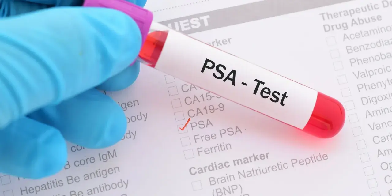 Rękawiczka w niebieskiej rękawiczce trzyma probówkę z krwią do testu PSA. Na formularzu zaznaczono PSA.