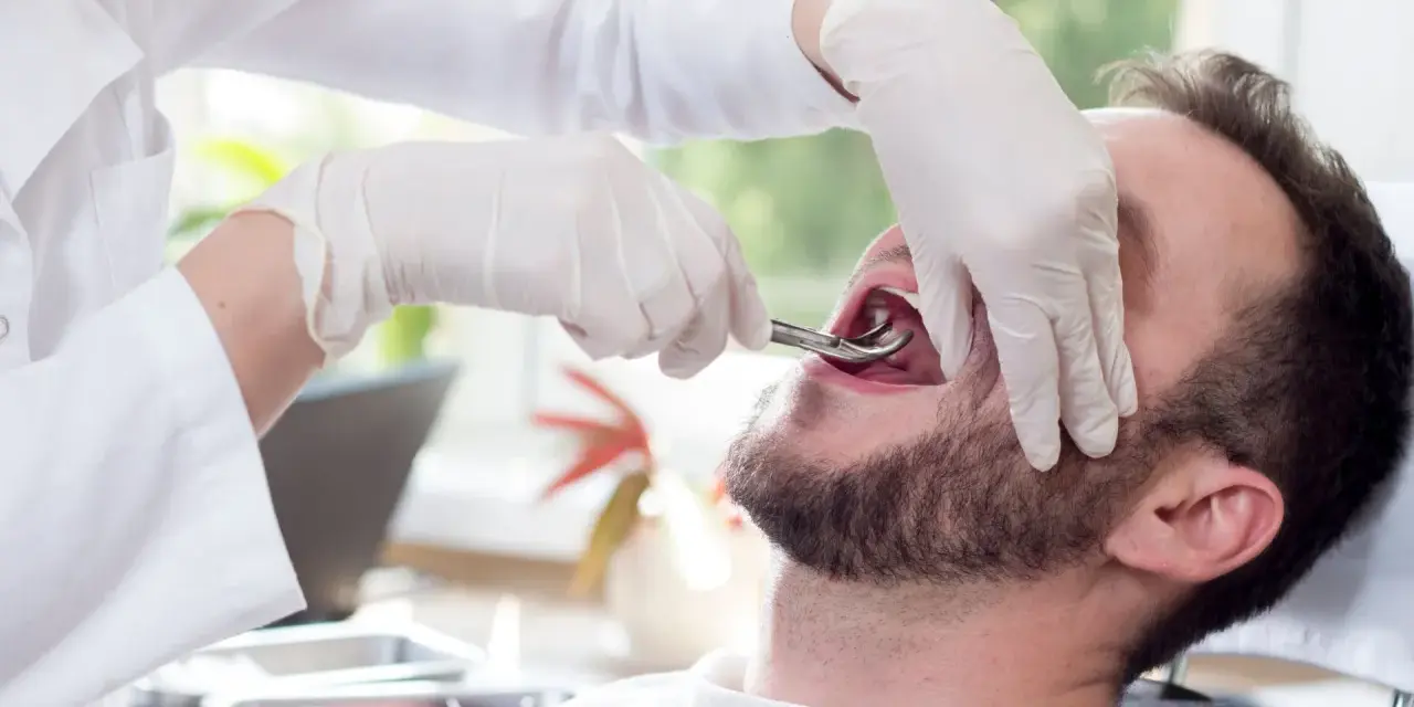 Dentysta w rękawiczkach używa kleszczy do usuwania zęba pacjentowi.