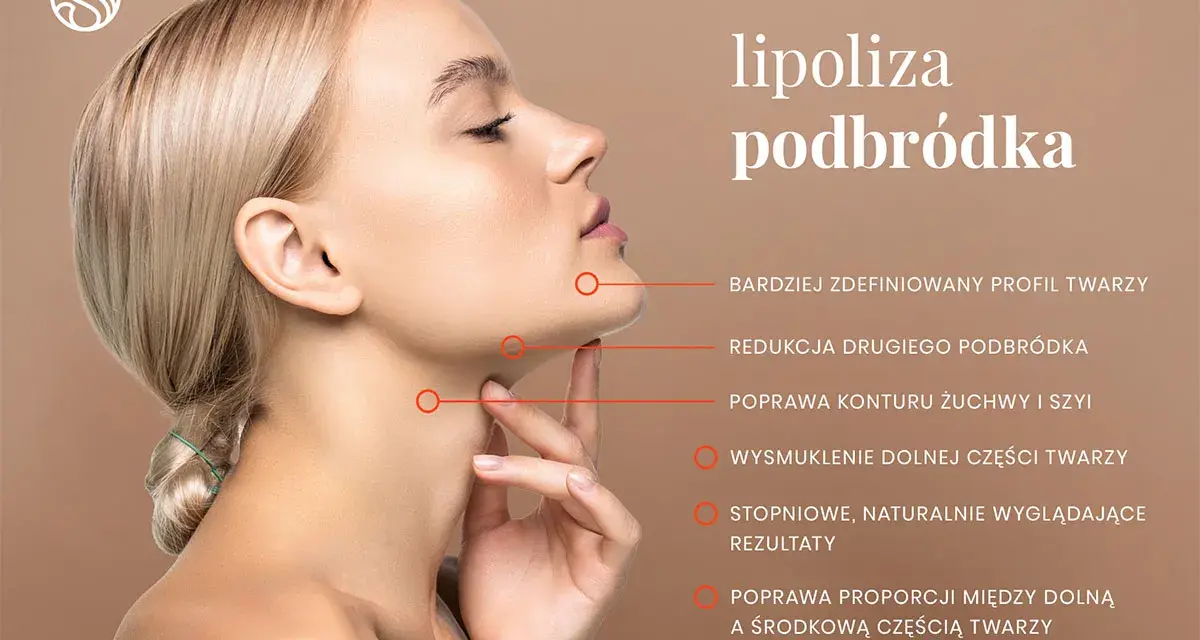 Kobieta po zabiegu lipolizy podbródka. Widoczna poprawa konturu żuchwy, redukcja drugiego podbródka i smuklejsza dolna część twarzy.