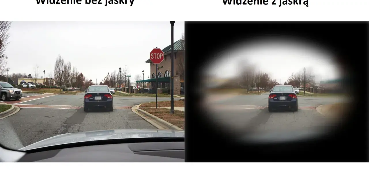 Porównanie widzenia: po lewej - normalne, po prawej - z jaskrą (widoczne ubytki w polu widzenia).