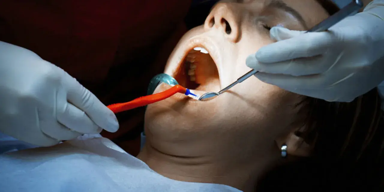 Dentysta bada usta pacjentki, która cierpi na ropień zęba. Widoczne narzędzia stomatologiczne i rozwierak.