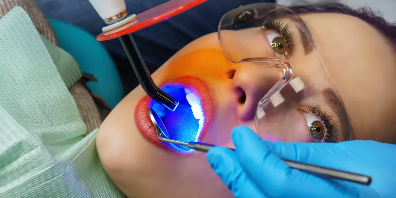 Zabieg malowania zębów światłem UV. Dentysta utwardza materiał, by uzyskać piękny uśmiech.