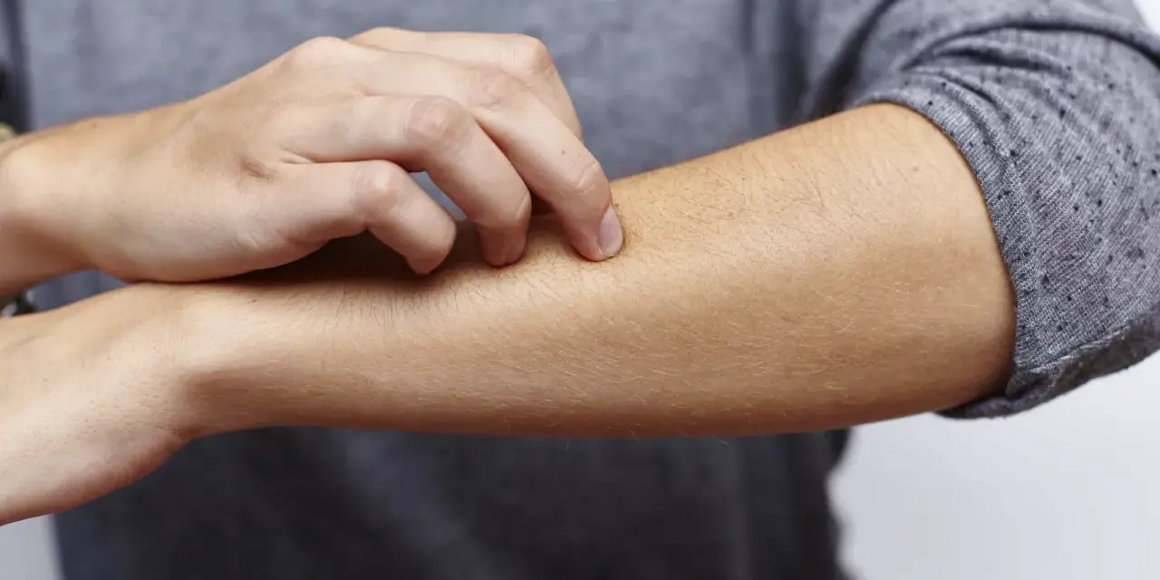 Juckende Haut am Arm, ein mögliches Symptom bei zu viel Zink.