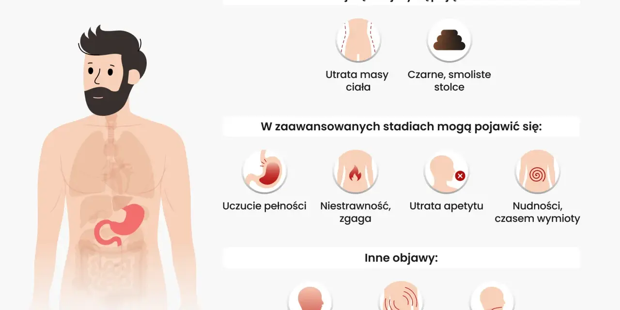 Objawy raka żołądka: utrata masy ciała, czarne stolce, niestrawność, nudności, ból pleców, trudności w połykaniu.