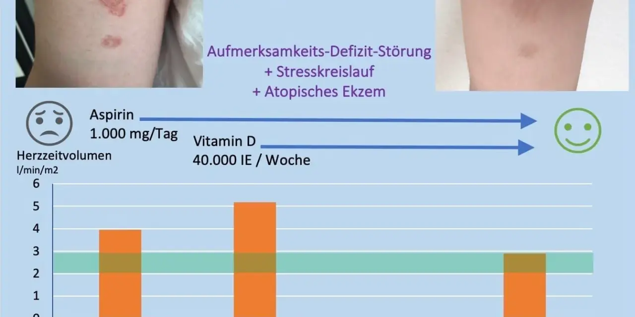 Vitamin D Mangel Symptome bei Erwachsenen: Erfahrungsberichte und Anzeichen