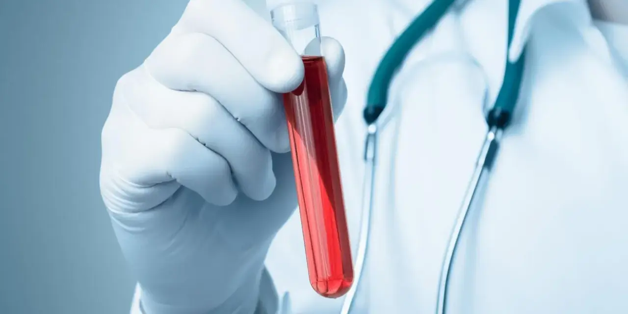 Rękawiczka z pipetą trzyma probówkę z czerwoną cieczą. Lekarz w białym kitlu i zielonym stetoskopie. Co to aptt?