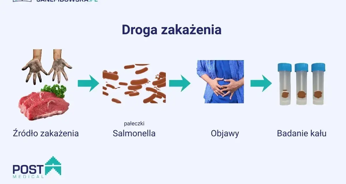 Droga zakażenia salmonellą: od surowego mięsa i brudnych rąk, przez pałeczki Salmonella, objawy bólu brzucha, po badanie kału.